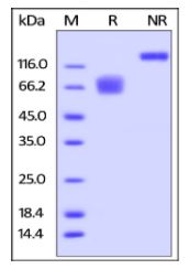 Human CD58, Fc Tag on SDS-PAGE under reducing (R) and non-reducing (NR) conditions. The gel was stained overnight with Coomassie Blue. The purity of the protein is greater than 95%.